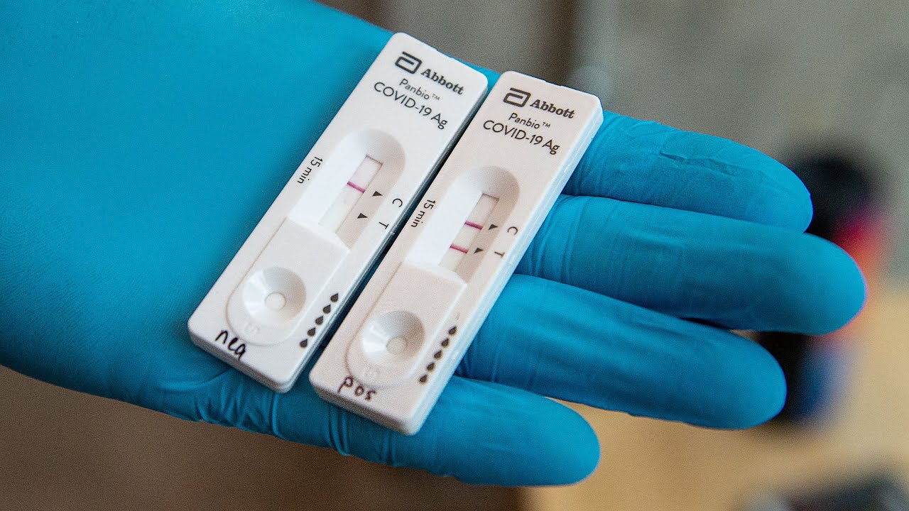 You are currently viewing What are the best rapid antigen test covid you can buy online?